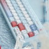 TIMSEKER 147 Keys Blue Aesthetic Custom PBT Keycaps, Cherry Profile,