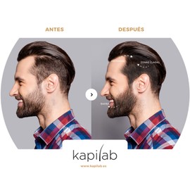 Kapilab Scalp Mask Roots Powder 4 g - Black - Conceals Thin Hair for First Use - Hair Concealer for Men and Women - Waterproof Hair Makeup
