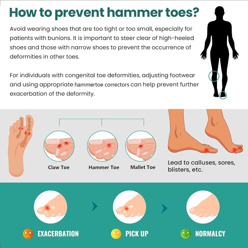 Welnove Hammertoe Corrector - 6 Pack Gel Toe Straighteners for