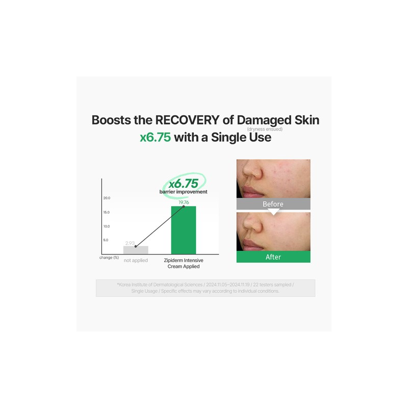 zipiderm [zipiderm]EGF Skin Barrier Intensive Cream 80ml