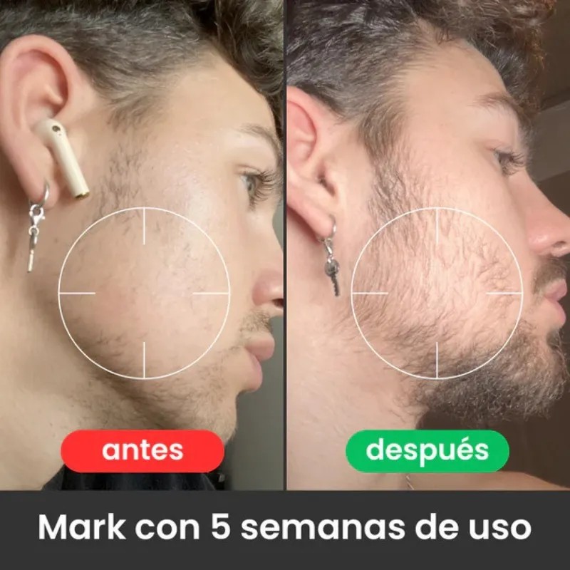 Bálsamo Para Barba - Cuidado Intenso 100ml 1 Piece