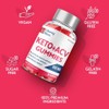 Liberty Bites Keto ACV Gummies, ACV Max Strength Formula Gummies
