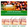 Aceite De Batana For El Crecimiento Del Cabello Con