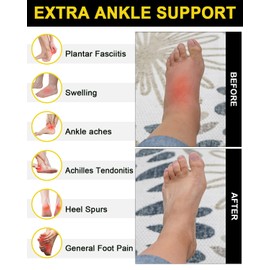 Ankle Compression Socks for Women & Men,Running Athletic Plantar Fasciitis Socks with Arch Support