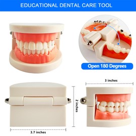 Dental Caries Teaching Model 1:1 Adult Life Size - Non-Removable Teeth Model for Education - Ideal for Demonstrations and Learning Dental Structures for Students Patients Professionals