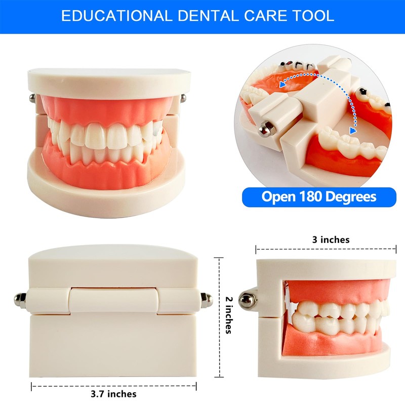 Dental Caries Teaching Model 1:1 Adult Life Size - Non-Removable