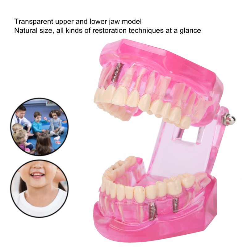 Transparent Adult Teeth Model Pathological Repair Studying Dental Teaching Tools