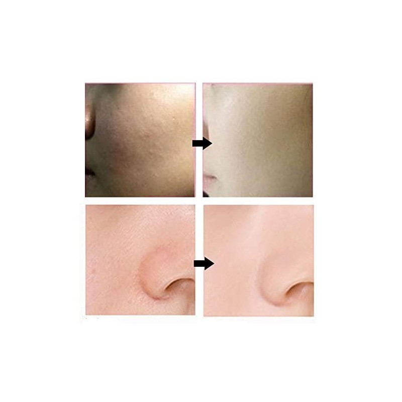 Bergamo] Magic Snail BB Cream 50ml /Intense Care Wrinkle Care