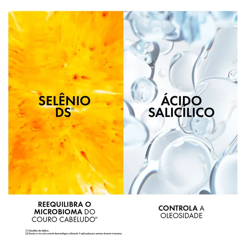 Champ Anticaspa Ds Para Cabello Normal A Graso, 300 G