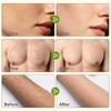 2-Step Facial Depilatory Kit, Depilatory Cream & Cyperus Serum