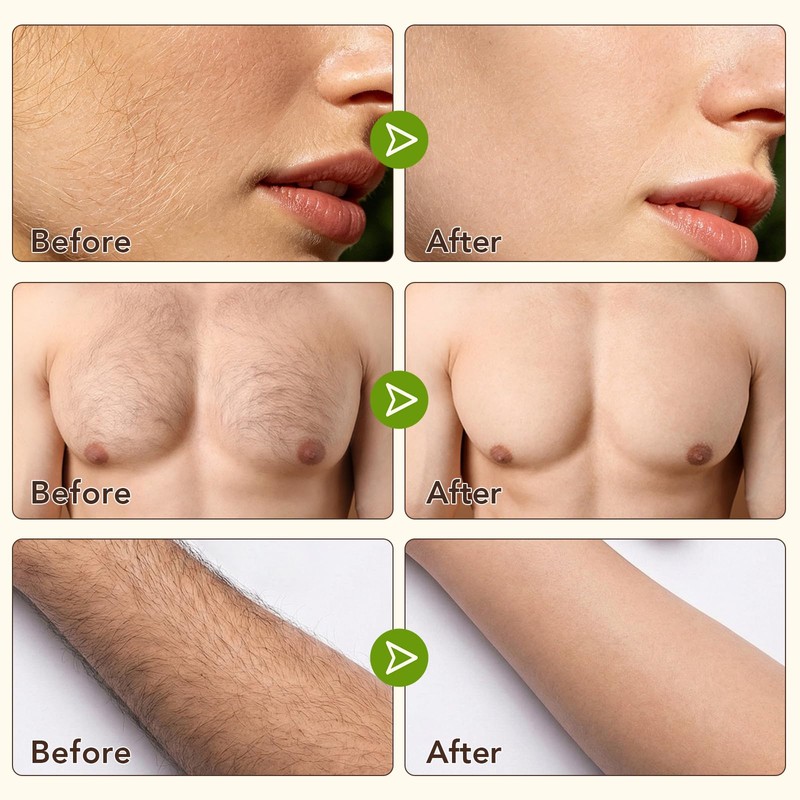 2-Step Facial Depilatory Kit, Depilatory Cream & Cyperus Serum