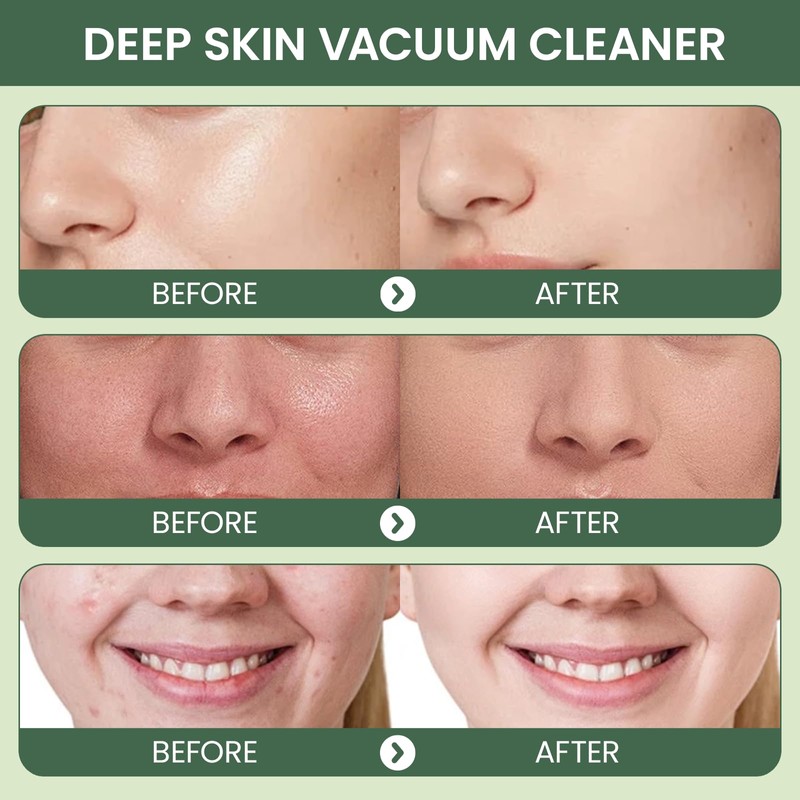 2 Stück Green Mask Stick, Grüner Tee Reinigungsmaske Stick, Tiefenreinigung