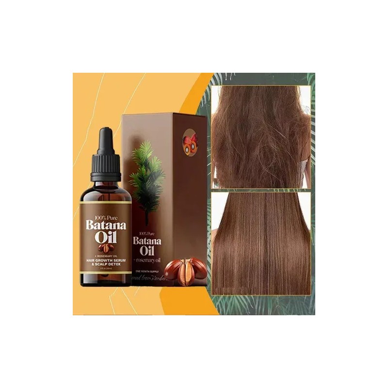 8 Aceite Capilar Batana Extracts Oil Y Aceite Romero Para