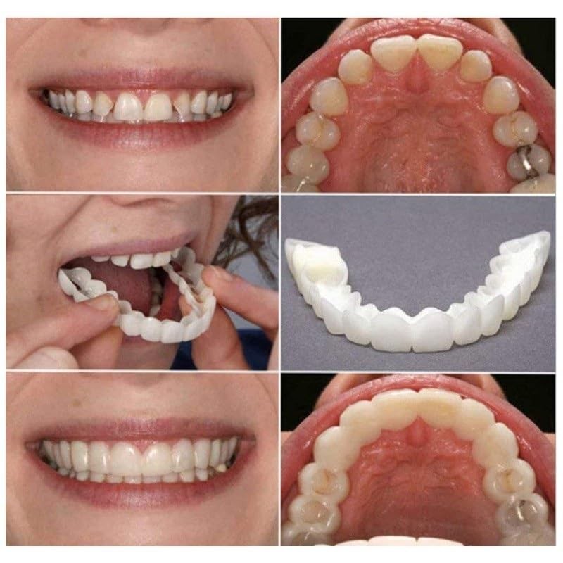 2 Pairs of Denture, Denture Temporary Restoration, Denture Temporary Denture,