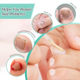 Nail Care Pen, Pack of 3 Nail Repair Pens, Nail Structure Essence, for Protection and Strengthening of Nails, for Care and Repair of Nails and Cuticles