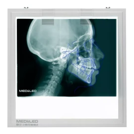 Med&Led Negatoscopio Dental Led 30x30 Lateral De Craneo, Panoramica
