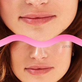 Instant Lip Filler for Plumped Lips in 30 Mins by Vitamasques, 3 Pack - Korean Skin Care Vegan Collagen, Hyaluronic Acid & 400 Dissolving Micro-Dart Tech for Instant & Long-Lasting Results