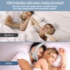 Snore Reduction Chin Strips - Chin Strap for Sleeping with