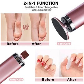 Electric Foot Callus Remover, MEBAO 2 in 1 Foot File for Feet,Adjustable Speed Foot Scrubber with Replacement Sandpaper Discs,Pedicure Tool with Digital Display for Dead Skin and Calluses Pink