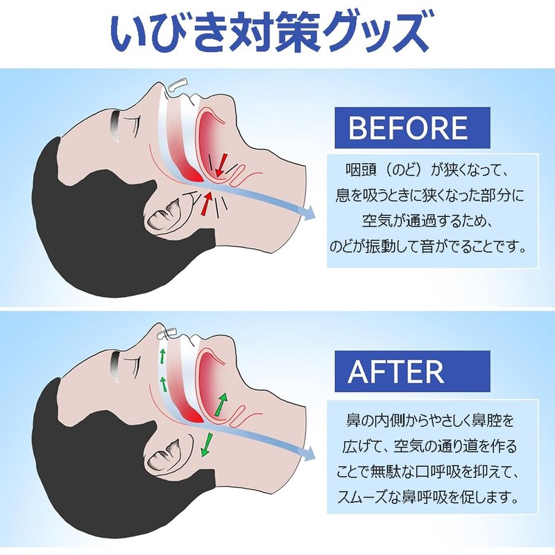 いびき防止グッズ 8個セット 鼻クリップ 鼾防止グッズ いびきグッズ いびき対策 イビキ 防止 鼻ピン ノーズピン