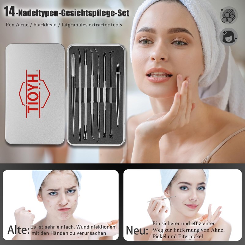 Mitesserentferner Komedonenquetscher Set,Mitesser Entferner,Hochwertiger Blackhead Remover,Akne-Entferner-Set,Pinzetten-Set mit Metallgehäuse(Silber)