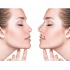 Rhinoplasty 7 Pzs Corrector Respingador Nariz Levanta Estiliza Perfila