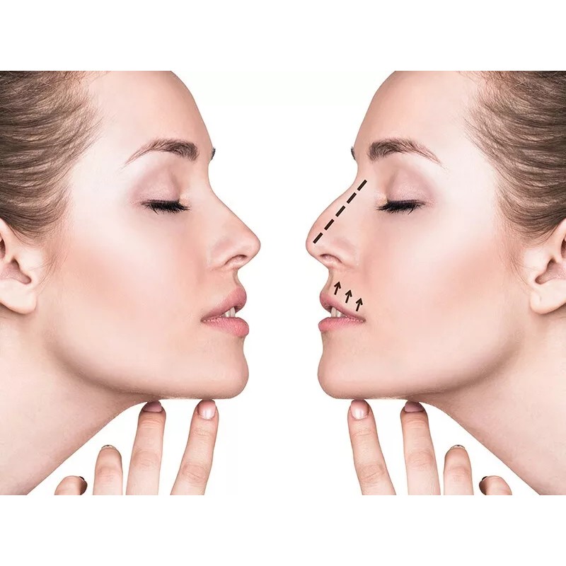 Rhinoplasty 7 Pzs Corrector Respingador Nariz Levanta Estiliza Perfila