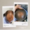 Tonico Vittale Crema Para Peinar Cabello Reparador Sellador Tonico Vittale
