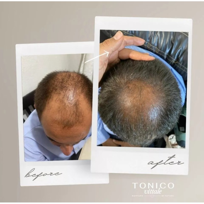 Tonico Vittale Crema Para Peinar Cabello Reparador Sellador Tonico Vittale