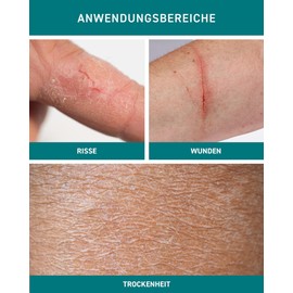N1 Mikrosilber Handcreme für sehr trockene Hände 100ml [inkl. Desinfektion] - Handcreme rissige Hände + Desinfektionsmittel für Hände in einem Produkt