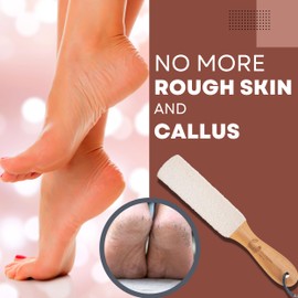 Eco Bath London Natural Pumice Foot File Hard Skin Remover for Women and Men - Callus & Dead Skin Remover for Feet with Wood Handle (White)