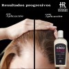 HR Hermoso Remedio Duo Shampoo Anticaida Crecimiento Reparador Cabello 7