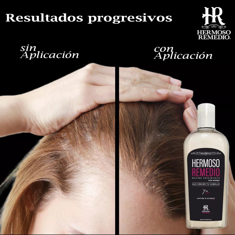 HR Hermoso Remedio Duo Shampoo Anticaida Crecimiento Reparador Cabello 7