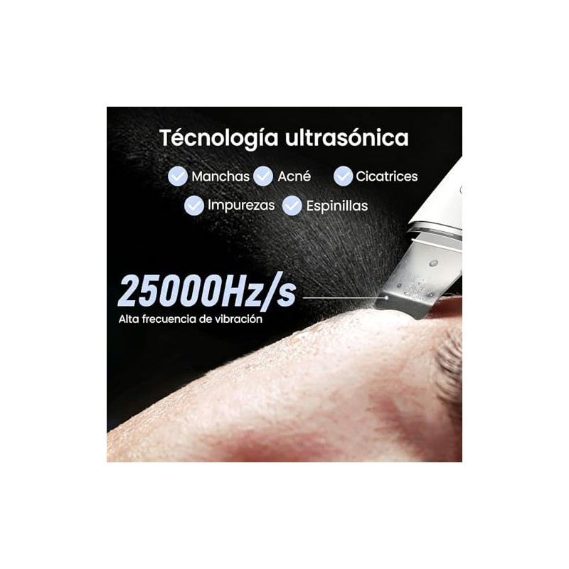 Peeling ultrasónico facial LOTOVERDE 4‑modos – Limpieza profunda y lifting