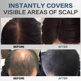 Scattered Hair Black, 4 g Roots Powder, Hair Thickener for Hair Thickening for Women and Men, Wind and Waterproof for Concealing Roots (Black)