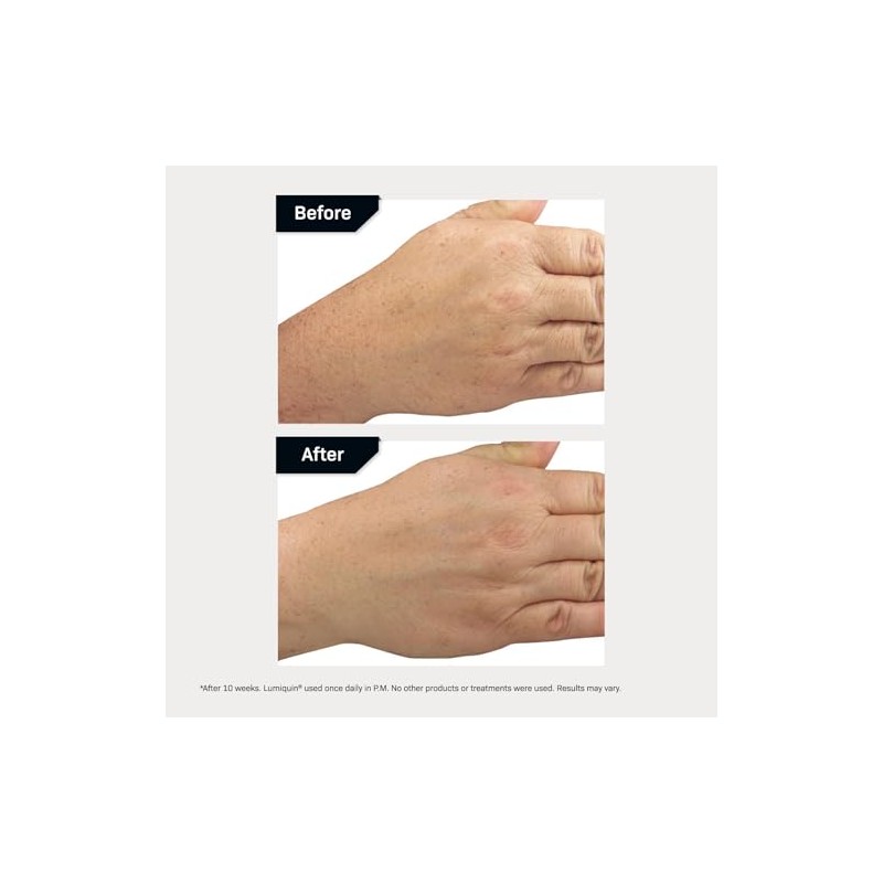 Revision Skincare Lumiquin, 48 g