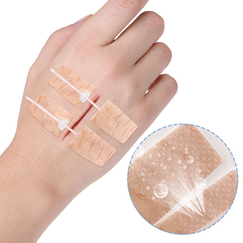 3 Pcs Wound Closure Strip Stitchless Self Adhesive Non Woven