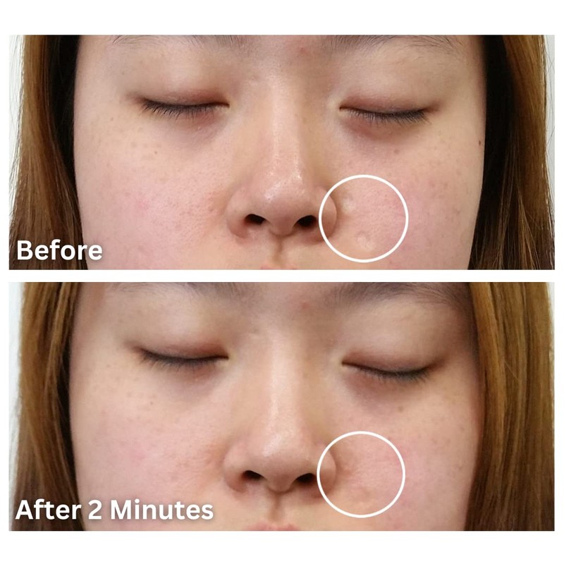 Dermaflage Dermaflage Single Applicator, Scar Concealer Refill (Light)