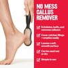 Revlon Callus Remover, Foot File for Wet or Dry Skin,