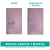 Uriage Hyseac 3-regul Cuidado Anti-imperfecciones 40ml Momento De Aplicacin Danoche