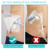 25 Pcs Waterproof Dialysis Catheter Shower Cover + Non-Stick Center