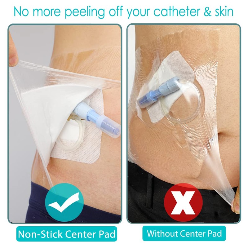 25 Pcs Waterproof Dialysis Catheter Shower Cover + Non-Stick Center