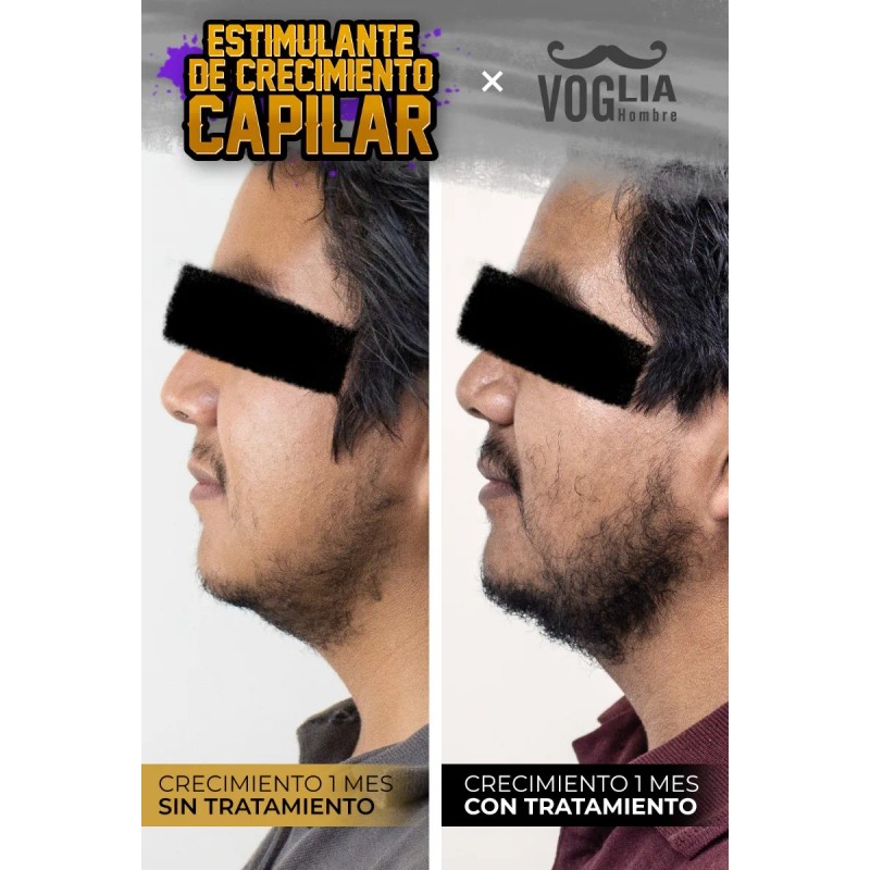 Tónico De Crecimiento Para Barba Y Cabello - Pack 6