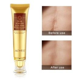Gel Reparador Aliver Cicatrices Acné Queloides Mixta Día Noche