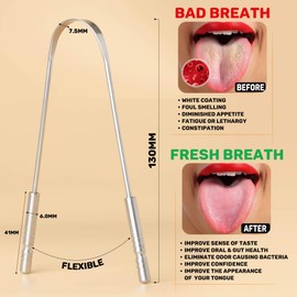 2 Pack Tongue Scraper with Travel Case, Bad Breath Treatment for Adults & Kids, Medical Grade 100% Stainless Steel Tongue Cleaner for Oral Care, Easy to Use Tongue Brush Alternative for Hygiene