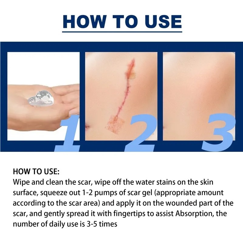 Jo Gel For El Cuidado De La Piel 1 Unidad