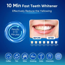 Kit De Blanqueamiento Dental Mysmile Para Dientes Sensibles