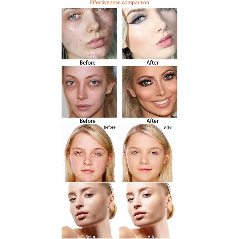 Paleta de Crema Base y Corrector Profesional Herramienta Maquillaje Cobertura