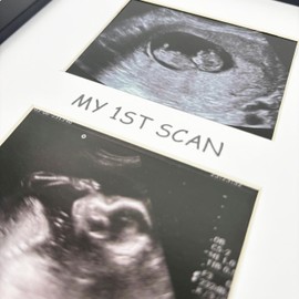 pf+a REAL GLASS Black Baby Scan Photo Frame 3 Picture - Frame For 1st, 2nd Scans and 6x4 Photograph