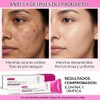 3pcs Crema Despigmentante Arbutina Ácido Tranexámico Aclarante Facial Manchas Oscuras